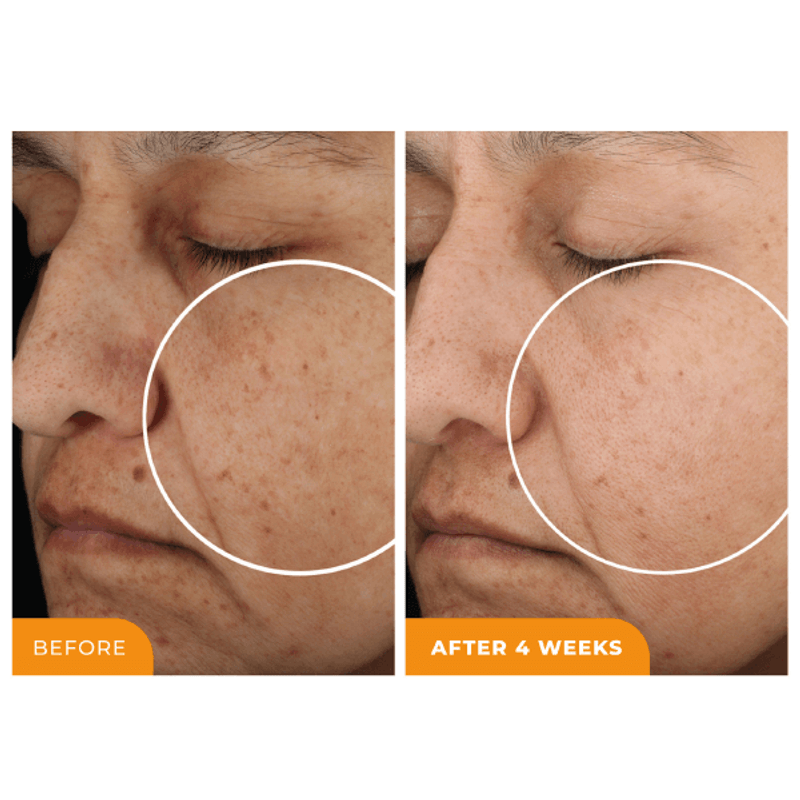 Suero-Iluminador-Universal-C-Skin-Refiner