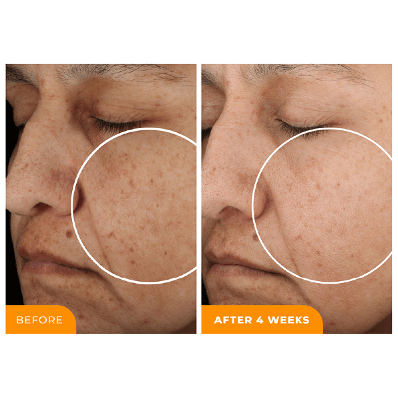 Mini-Suero-Iluminador-Universal-C-Skin-Refiner